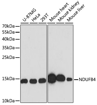 Western blot - NDUFB4 Polyclonal Antibody 