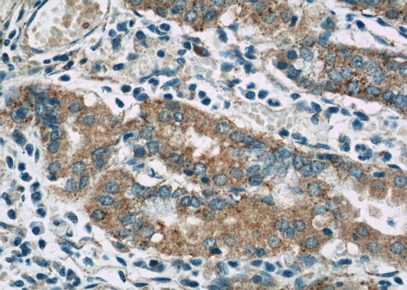 Immunohistochemistry of paraffin-embedded human stomach tissue slide using Catalog No:110534(FAU Antibody) at dilution of 1:50 (under 40x lens)