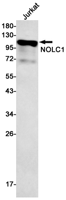 Western blot detection of NOLC1 in Jurkat cell lysates using NOLC1 Rabbit mAb(1:500 diluted).Predicted band size:74kDa.Observed band size:110kDa.