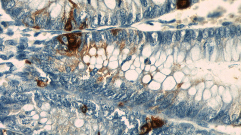 Immunohistochemical of paraffin-embedded human colon using Catalog No:109287(CHGA antibody) at dilution of 1:50 (under 40x lens)