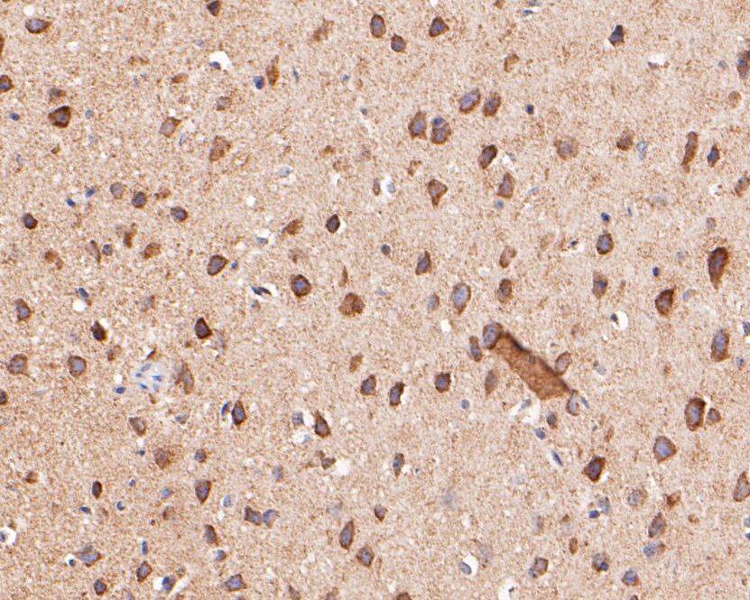 Fig6: Immunohistochemical analysis of paraffin-embedded mouse brain tissue using anti-KCNK18 antibody. The section was pre-treated using heat mediated antigen retrieval with Tris-EDTA buffer (pH 8.0-8.4) for 20 minutes.The tissues were blocked in 5% BSA for 30 minutes at room temperature, washed with ddH2O and PBS, and then probed with the primary antibody ( 1/200) for 30 minutes at room temperature. The detection was performed using an HRP conjugated compact polymer system. DAB was used as the chromogen. Tissues were counterstained with hematoxylin and mounted with DPX.