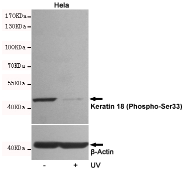 Western blot analysis of extracts from Hela cells, untreated or UV-treated, using KRT18(Phospho-Ser33) Rabbit pAb (1:5000 diluted).Predicted band size:46kDa.Observed band size:46kDa..