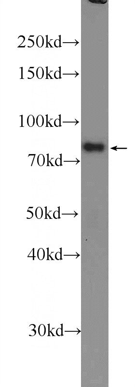 mouse brain tissue were subjected to SDS PAGE followed by western blot with Catalog No:111614(IFFO1 Antibody) at dilution of 1:1000