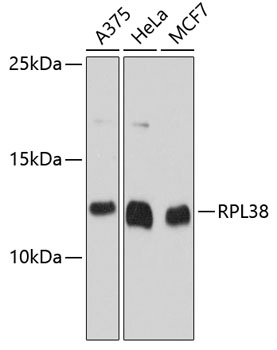 Western blot - RPL38 Polyclonal Antibody 