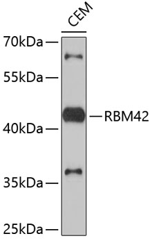 Western blot - RBM42 Polyclonal Antibody 