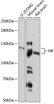 Western blot - HR Polyclonal Antibody 
