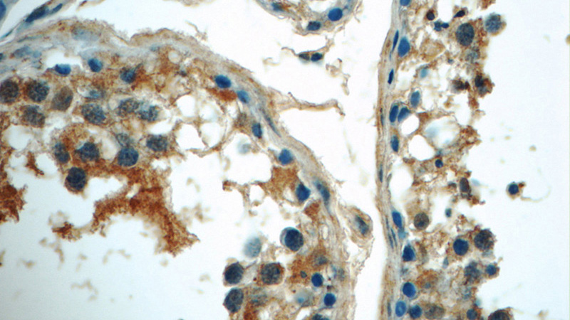 Immunohistochemistry of paraffin-embedded human testis tissue slide using Catalog No:108399(BAALC Antibody) at dilution of 1:50 (under 40x lens)