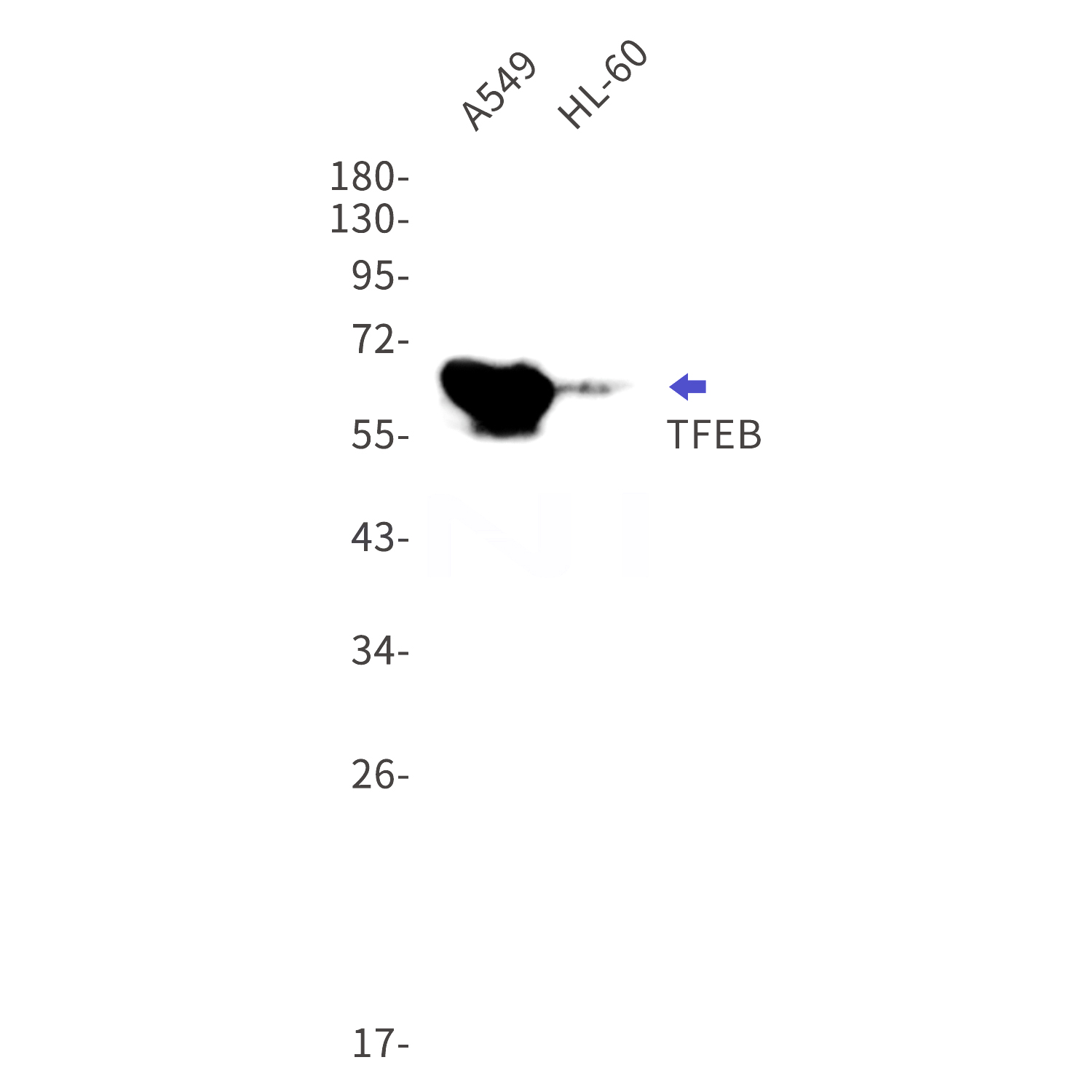 Western blot detection of TFEB in A549,HL-60 cell lysates using TFEB Rabbit mAb(1:1000 diluted).Predicted band size:53kDa.Observed band size:65-70kDa.