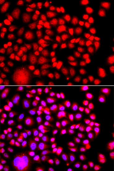 Immunofluorescence - TESK2 Polyclonal Antibody 