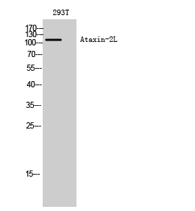 Fig1:; Western Blot analysis of 293T cells using Ataxin-2L Polyclonal Antibody diluted at 1: 2000