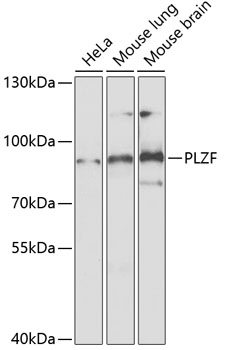 Western blot - PLZF Polyclonal Antibody 