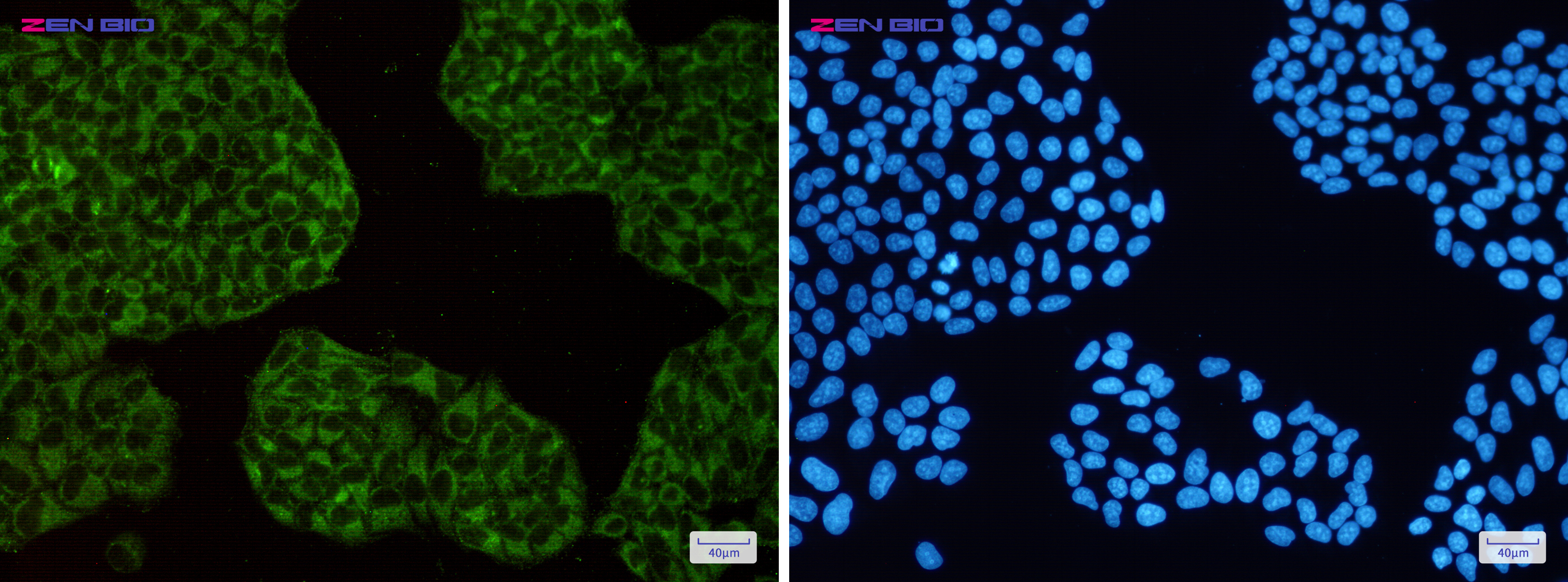 Immunocytochemistry of Ferritin(green) in Hela cells using Ferritin Rabbit pAb at dilution 1/50, and DAPI(blue)