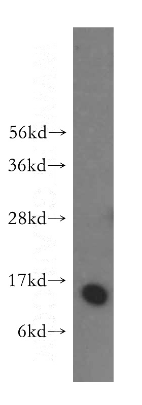 HeLa cells were subjected to SDS PAGE followed by western blot with Catalog No:109537(CRABP2 antibody) at dilution of 1:500