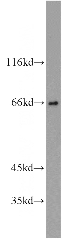 Raji cells were subjected to SDS PAGE followed by western blot with Catalog No:109419(MYC antibody) at dilution of 1:800