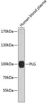 Western blot - PLG Polyclonal Antibody 