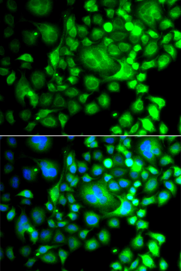 Immunofluorescence - SNX3 Polyclonal Antibody 