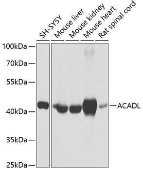 Western blot - ACADL Polyclonal Antibody 