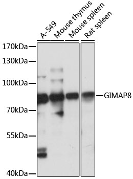 Western blot - GIMAP8 Polyclonal Antibody 