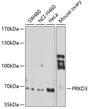 Western blot - PRKD3 Polyclonal Antibody 