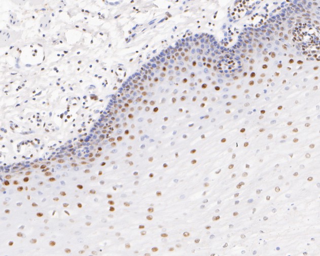 Fig7:; Immunohistochemical analysis of paraffin-embedded human esophagus tissue using anti-GATAD2A antibody. The section was pre-treated using heat mediated antigen retrieval with sodium citrate buffer (pH 6.0) for 20 minutes. The tissues were blocked in 5% BSA for 30 minutes at room temperature, washed with ddH; 2; O and PBS, and then probed with the primary antibody ( 1/200) for 30 minutes at room temperature. The detection was performed using an HRP conjugated compact polymer system. DAB was used as the chromogen. Tissues were counterstained with hematoxylin and mounted with DPX.