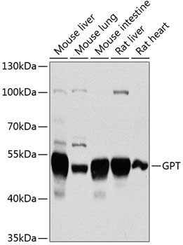 Western blot - GPT Polyclonal Antibody 