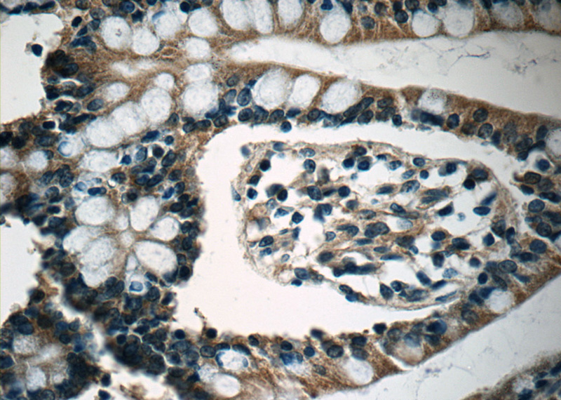 Immunohistochemistry of paraffin-embedded human small intestine tissue slide using Catalog No:108242(ARF1 Antibody) at dilution of 1:50 (under 40x lens)