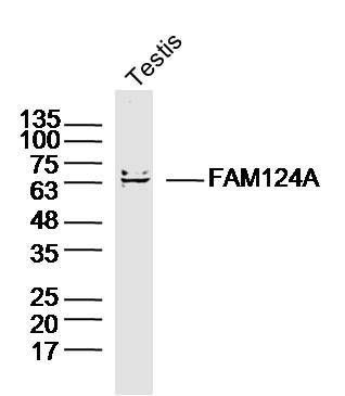 Fig3: Sample: Testis (Mouse) Lysate at 40 ug; Primary: Anti-FAM124A at 1/300 dilution; Secondary: IRDye800CW Goat Anti-Rabbit IgG at 1/20000 dilution; Predicted band size: 60kD; Observed band size: 63kD
