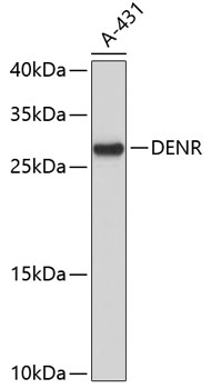 Western blot - DENR Monoclonal Antibody 