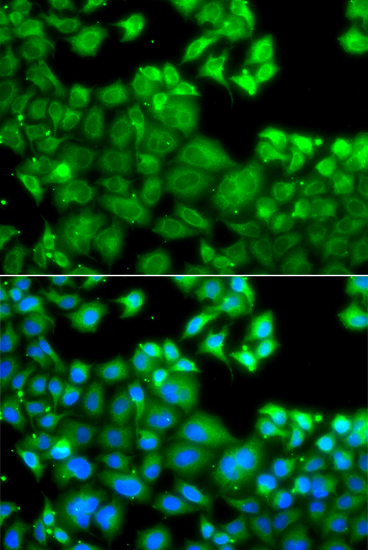 Immunofluorescence - NLRC4 Polyclonal Antibody 