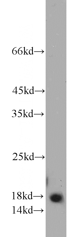 HEK-293 cells were subjected to SDS PAGE followed by western blot with Catalog No:113907(PIN1 antibody) at dilution of 1:1000