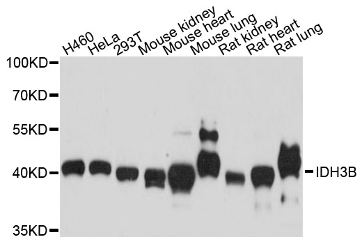 Western blot - IDH3B Polyclonal Antibody 