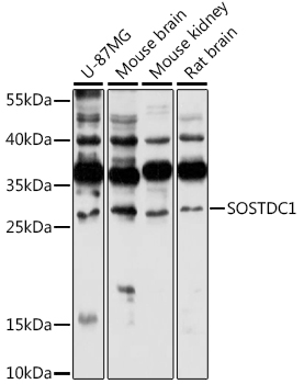 Western blot - SOSTDC1 Polyclonal Antibody 