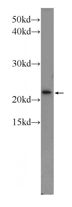 Jurkat cells were subjected to SDS PAGE followed by western blot with Catalog No:116127(TIMM23 antibody) at dilution of 1:600