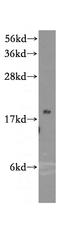 HepG2 cells were subjected to SDS PAGE followed by western blot with Catalog No:112852(MRPS25 antibody) at dilution of 1:500