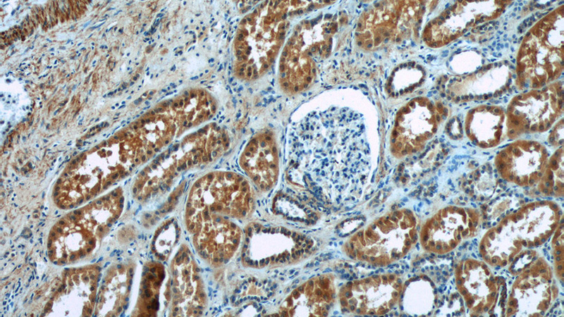 Immunohistochemistry of paraffin-embedded human kidney tissue slide using Catalog No:116454(TXNIP Antibody) at dilution of 1:50 (under 10x lens)