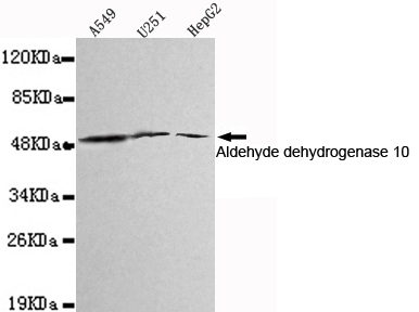Western blot detection of Aldehyde dehydrogenase 10 in A549,U251 and HepG2 cell lysates using Aldehyde dehydrogenase 10 mouse mAb (1:1000 diluted).Predicted band size:55KDa.Observed band size:55KDa.