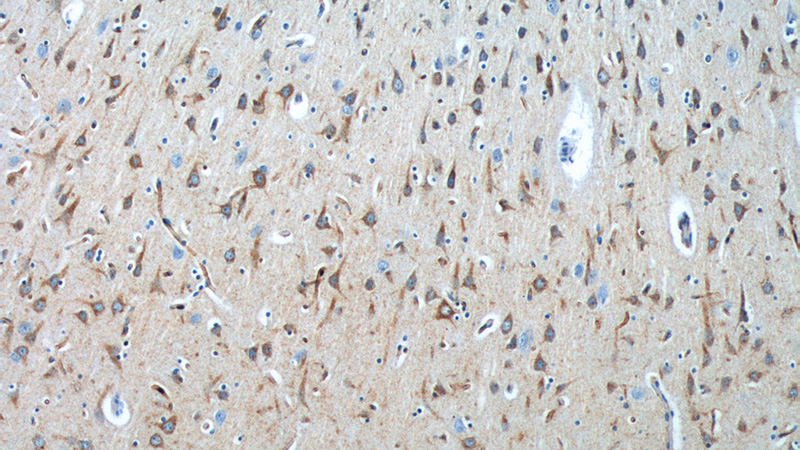 Immunohistochemistry of paraffin-embedded human brain tissue slide using Catalog No:115507(SORT1 Antibody) at dilution of 1:100 (under 10x lens).