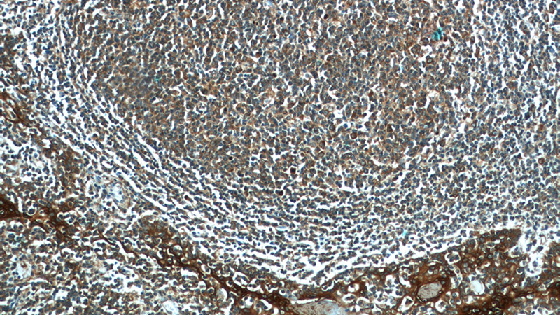 Immunohistochemistry of paraffin-embedded human tonsillitis slide using Catalog No:108670(C15orf53 Antibody) at dilution of 1:50 (under 10x lens)