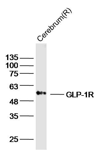 Fig2: Sample: Cerebrum(Rat) Lysate at 40 ug; Primary: Anti-GLP-1R at 1/300 dilution; Secondary: IRDye800CW Goat Anti-Rabbit IgG at 1/20000 dilution; Predicted band size: 51 kD; Observed band size: 51 kD