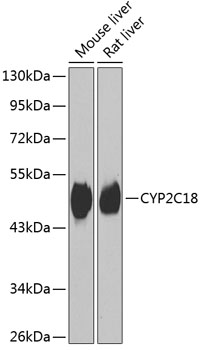 Western blot - CYP2C18 Polyclonal Antibody 