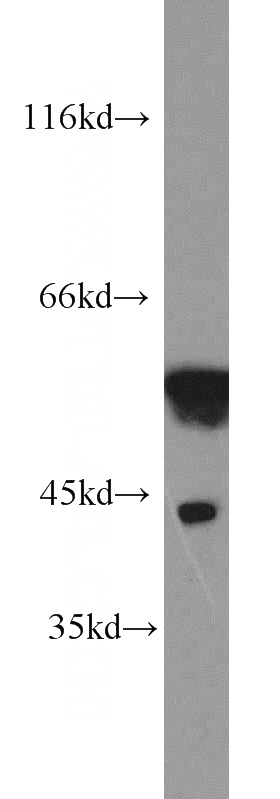 human brain tissue were subjected to SDS PAGE followed by western blot with Catalog No:112608(MICA antibody) at dilution of 1:500