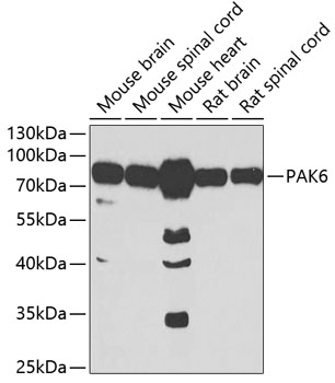 Western blot - PAK6 Polyclonal Antibody 