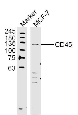 Fig3: Sample:; MCF-7 (Human) Lysate at 40 ug; Primary: Anti-CD45 at 1/300 dilution; Secondary: IRDye800CW Goat Anti-Rabbit IgG at 1/20000 dilution; Predicted band size: 137 kD; Observed band size: 130 kD