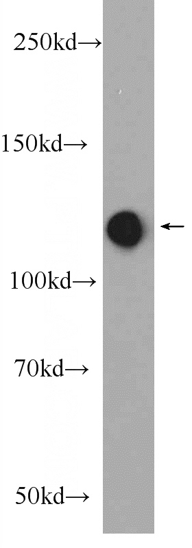 Jurkat cells were subjected to SDS PAGE followed by western blot with Catalog No:114607(RBM25 Antibody) at dilution of 1:600