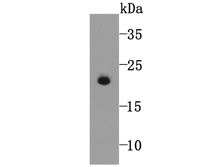 Fig1: Western blot analysis of GPX5 on human sperm tissue lysate using anti-GPX5 antibody at 1/5,000 dilution.
