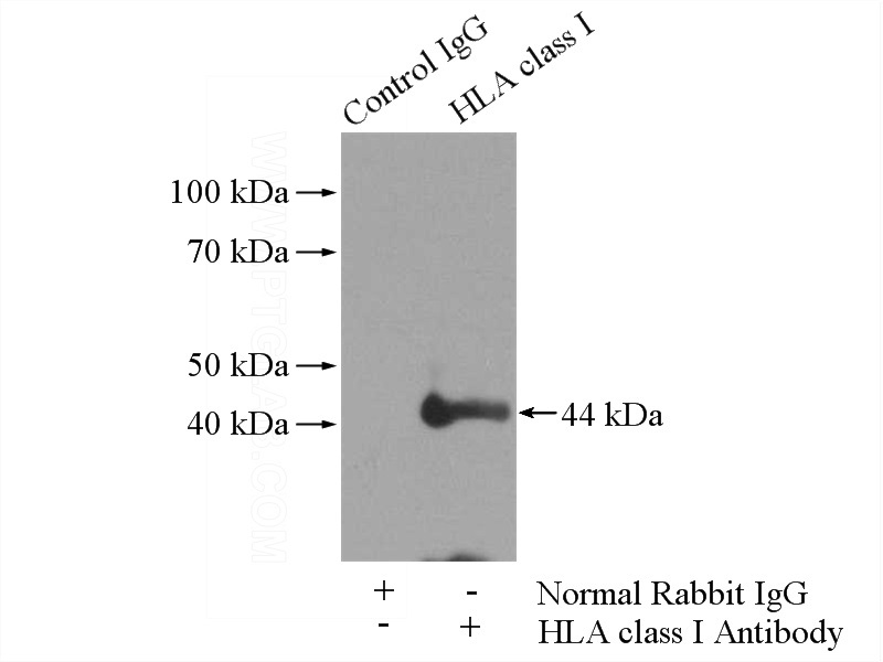 IP Result of anti-HLA class I (HLA-C) (IP:Catalog No:111416, 4ug; Detection:Catalog No:111416 1:1000) with Jurkat cells lysate 2400ug.