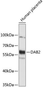 Western blot - DAB2 Polyclonal Antibody 