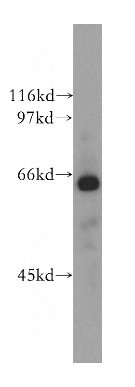 human heart tissue were subjected to SDS PAGE followed by western blot with Catalog No:109091(CDC14A antibody) at dilution of 1:500