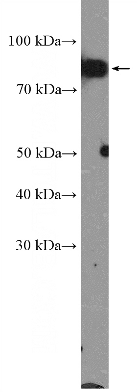 K-562 cells were subjected to SDS PAGE followed by western blot with Catalog No:116872(XRCC1 Antibody) at dilution of 1:600