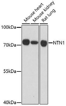 Western blot - NTN1 Polyclonal Antibody 